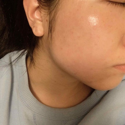 ミノン アミノモイスト モイストチャージ ミルク/ミノン/乳液を使ったクチコミ(4枚目)