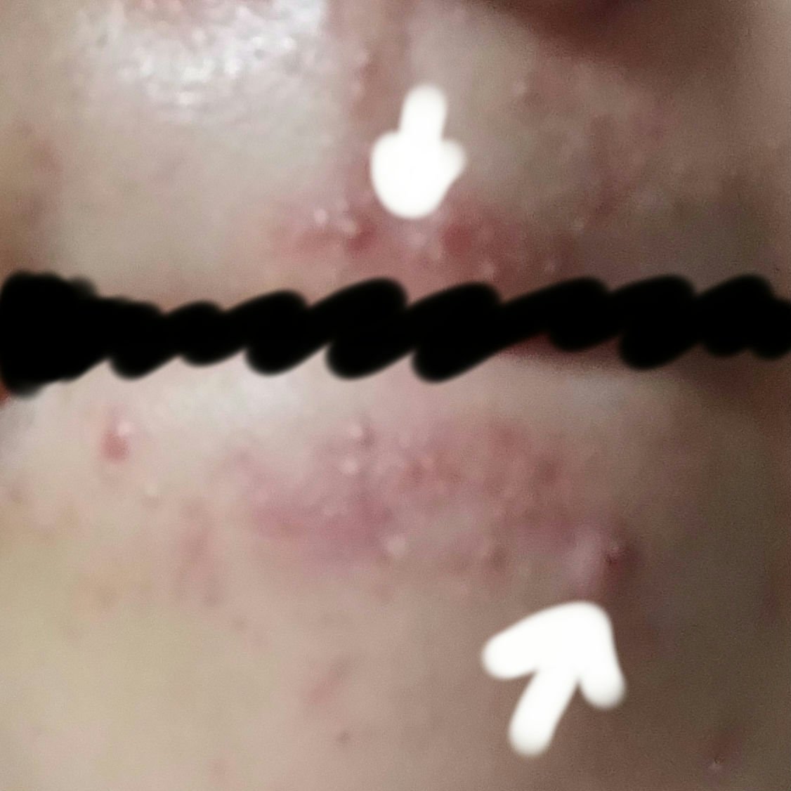 薬用泡のふんわり洗顔/スキンライフ/泡洗顔を使ったクチコミ（2枚目）