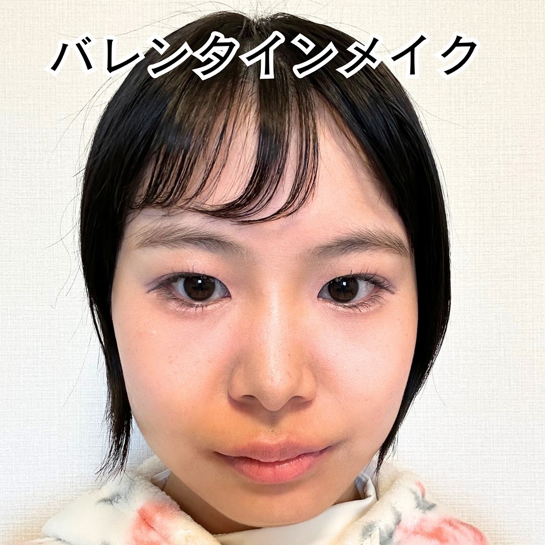 ひとえ・奥ぶたえ用カーラー/アイプチ®/ビューラーを使ったクチコミ（1枚目）