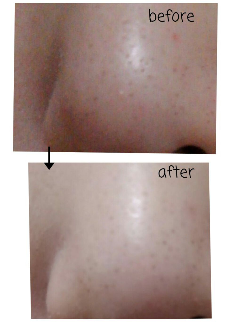 直ヌリジェル石けん/デオナチュレ/ボディソープを使ったクチコミ(5枚目)