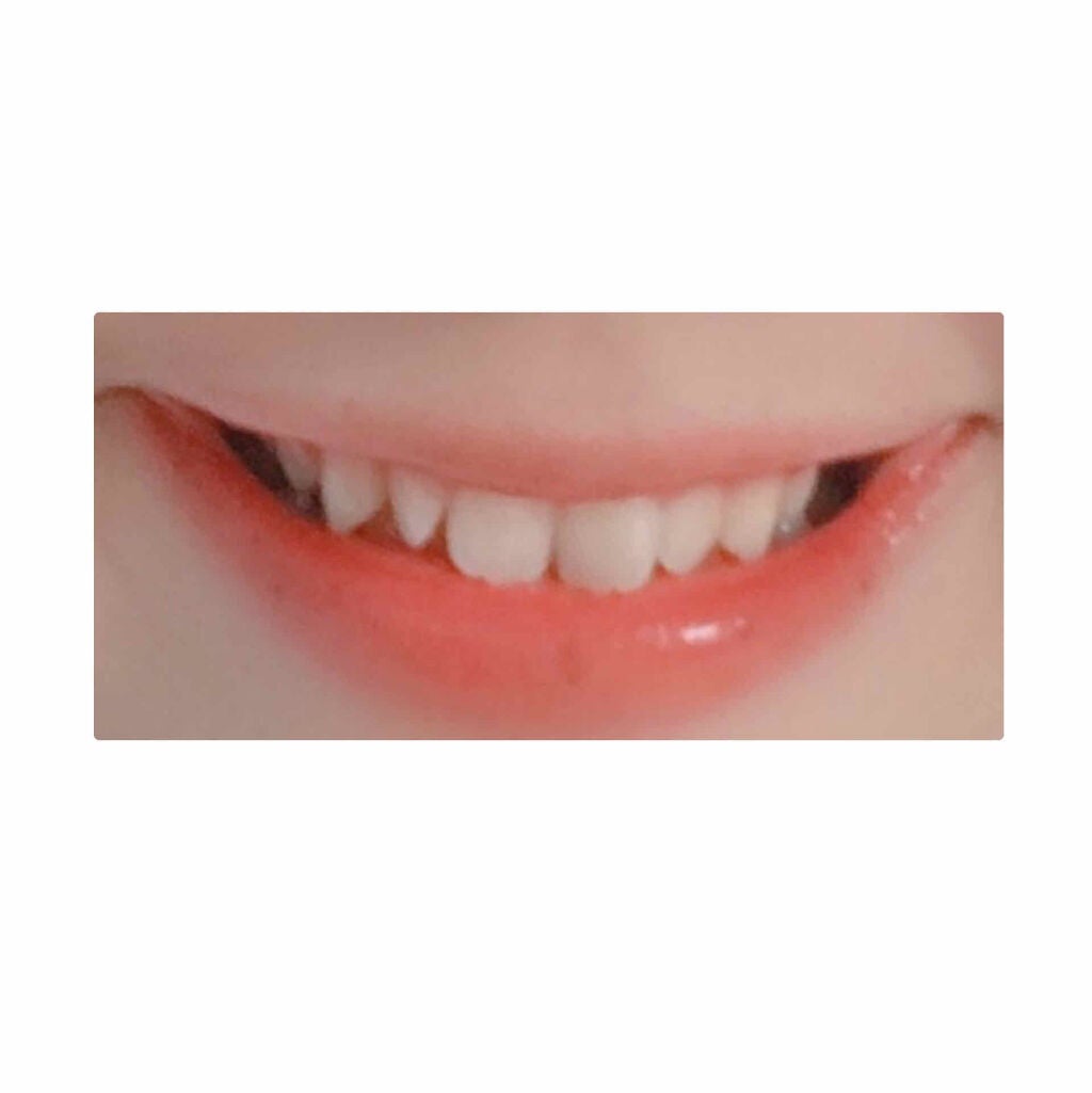 モイスチャーリップ UV/ニベア/リップクリームを使ったクチコミ(2枚目)