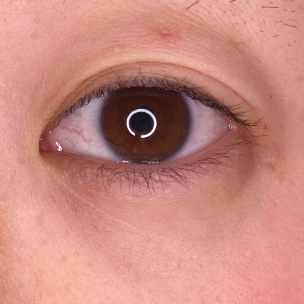 肌色タイプ/バンドエイド/その他を使ったクチコミ（3枚目）