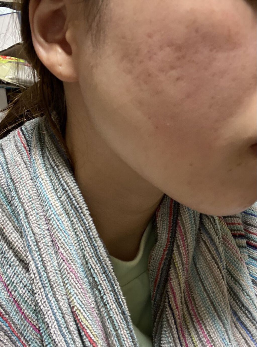 モイスチャー リッチローション(とてもしっとり)/アルージェ/化粧水を使ったクチコミ（1枚目）