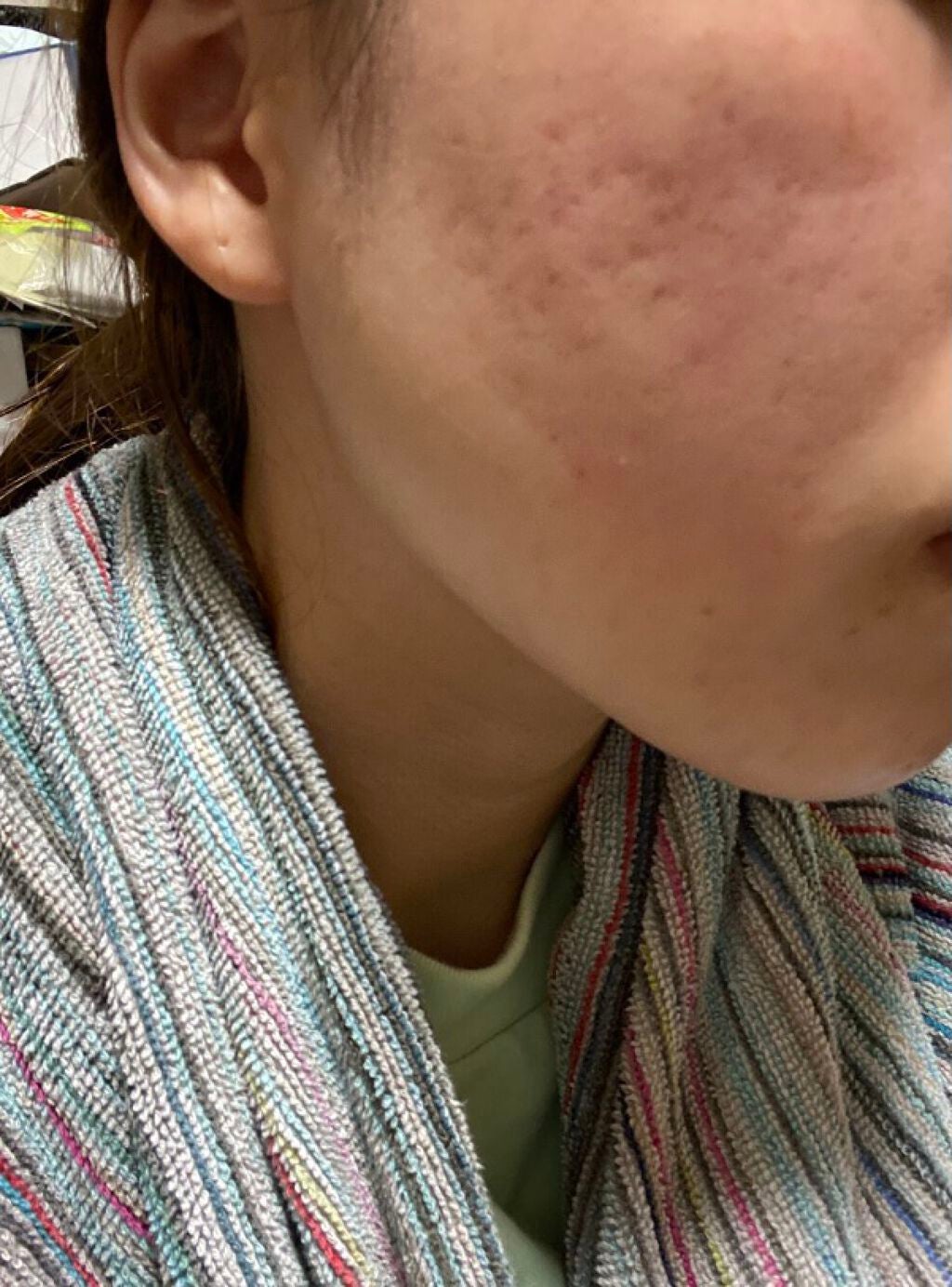 モイスチャー リッチローション(とてもしっとり)/アルージェ/化粧水を使ったクチコミ(1枚目)