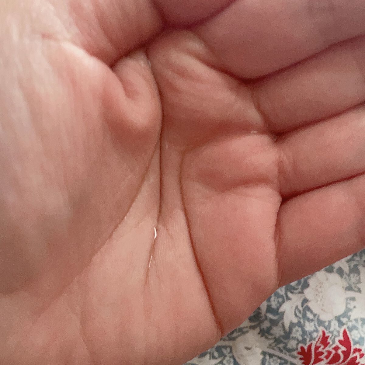 VC100エッセンスローション EX/ドクターシーラボⓇ/化粧水を使ったクチコミ（3枚目）