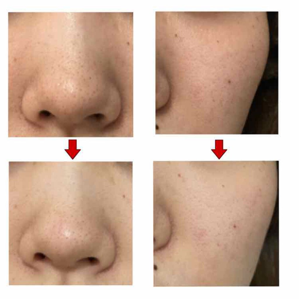 ロゼット洗顔パスタ 海泥スムース/ロゼット/洗顔フォームを使ったクチコミ(2枚目)