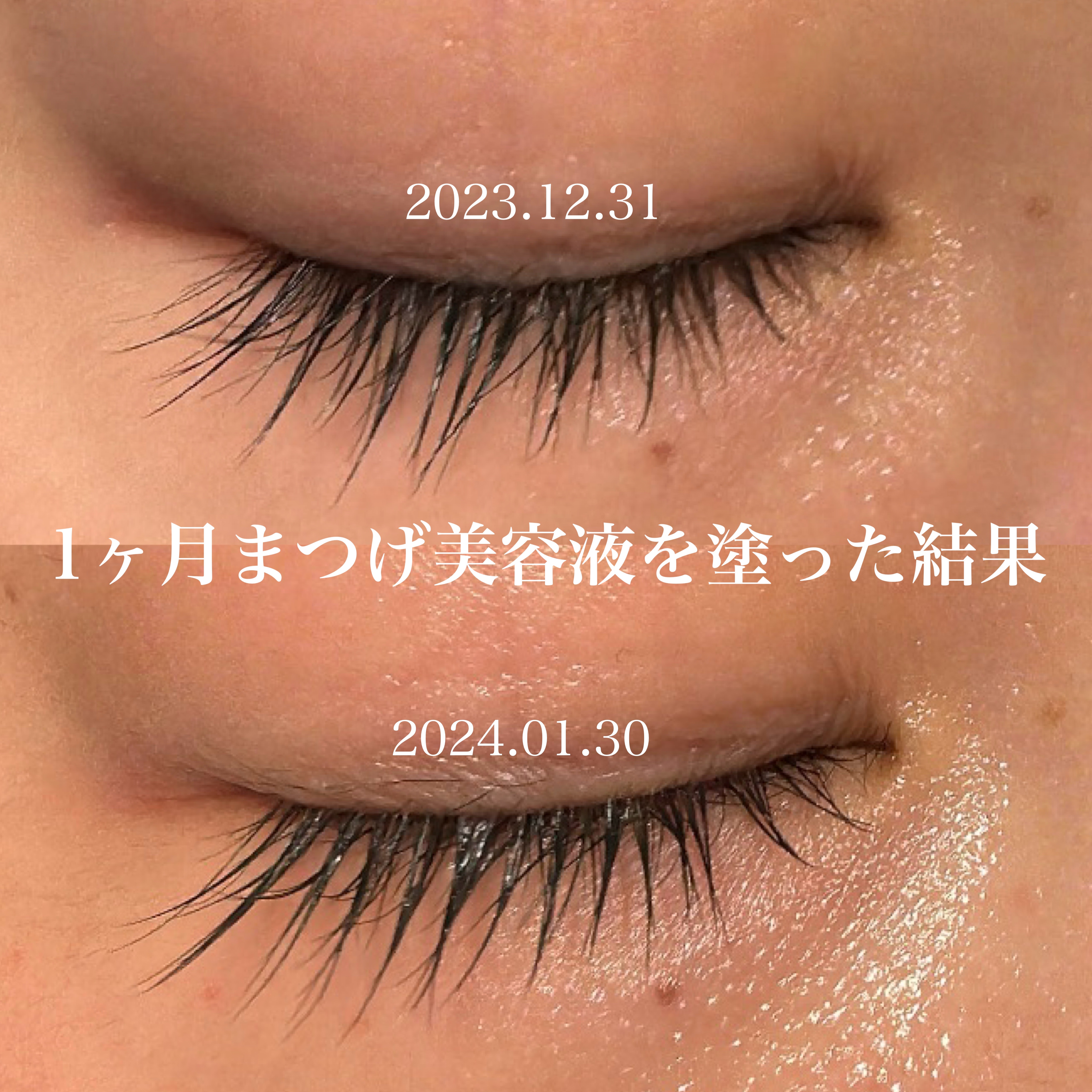 専用、まつげ美容液4本プラス1本プレゼントキャンペーン まつ毛美容液 リンプラッシュ プロが認めた まつげ美容液 日本製