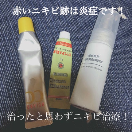 ドルマイコーチ軟膏(医薬品)/ゼリア新薬工業/その他を使ったクチコミ(1枚目)