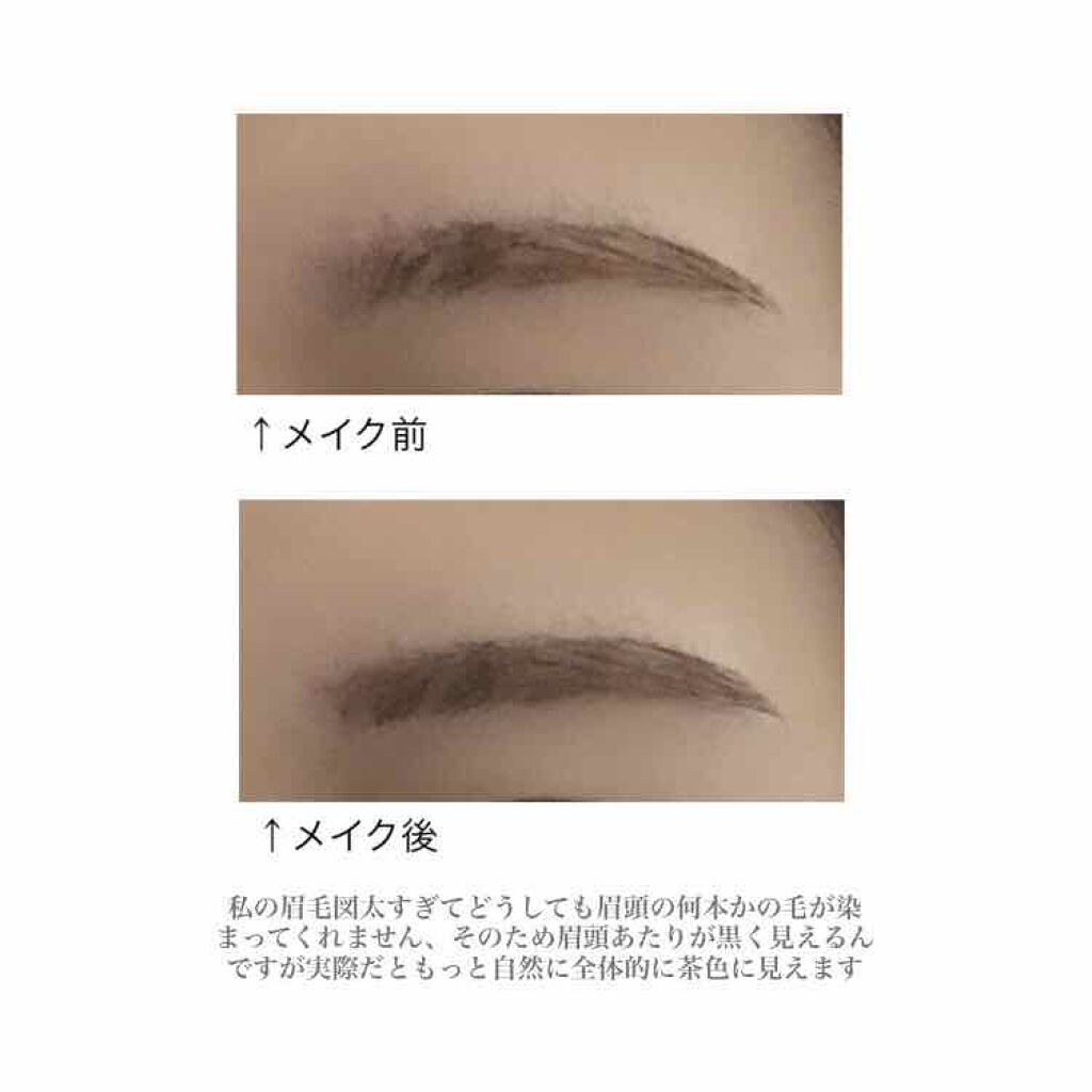 脱色クリーム スピーディー/エピラット/ムダ毛ケアを使ったクチコミ（3枚目）