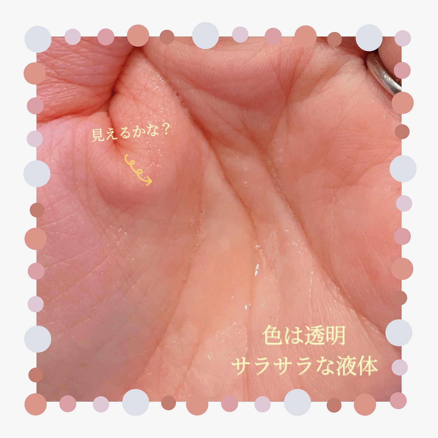 薬用スカルプセラム/wicot/頭皮ローションを使ったクチコミ(3枚目)