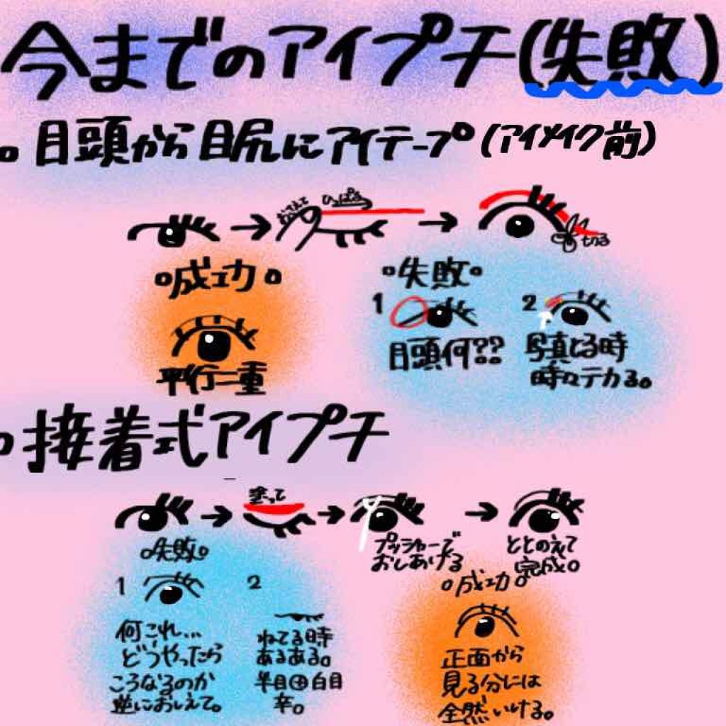 のびーるアイテープ（絆創膏タイプ、レギュラー）/DAISO/二重まぶた用アイテムを使ったクチコミ（2枚目）