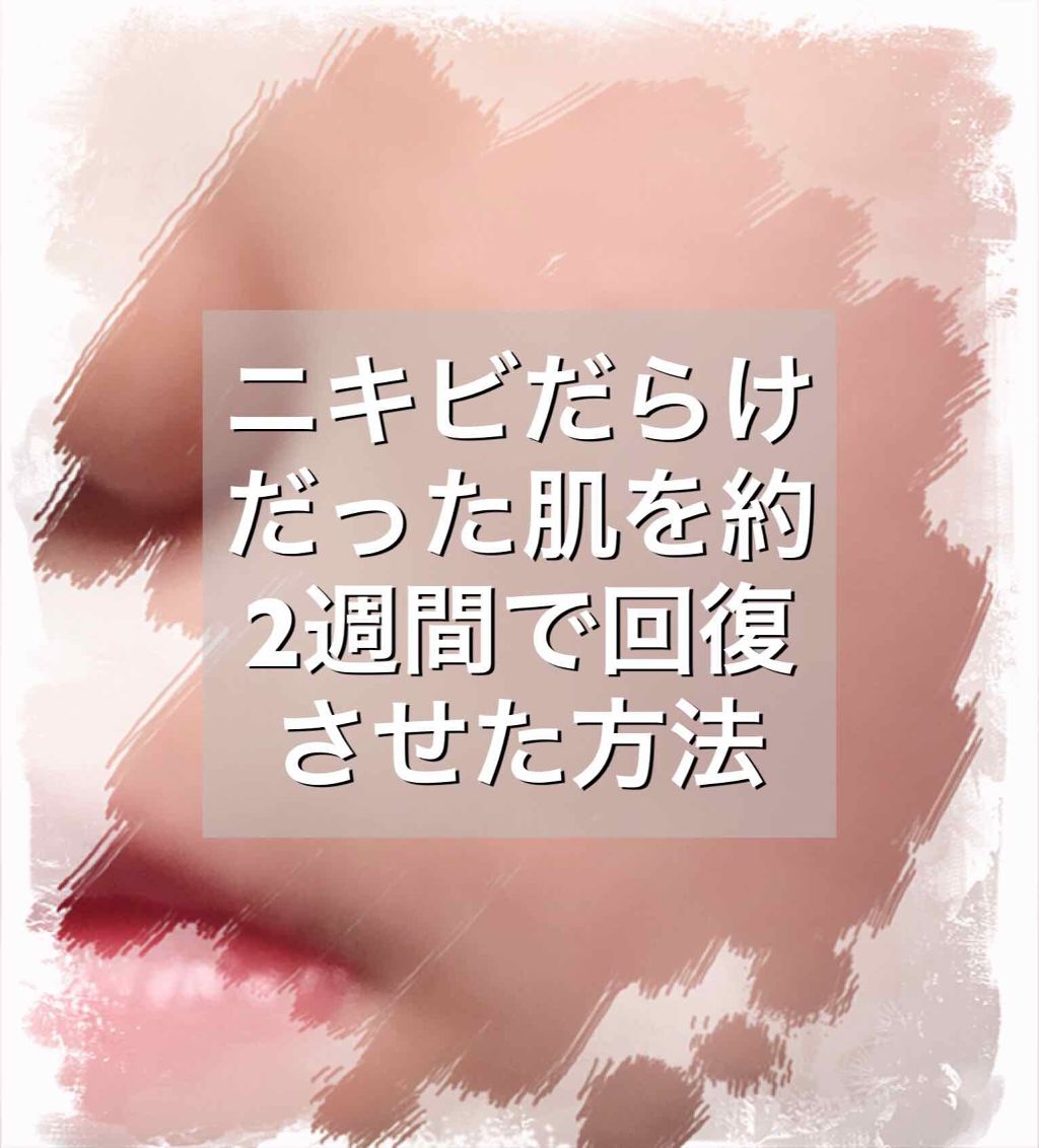 ニキビ治療薬クリーム (医薬品)/クレアラシル/その他を使ったクチコミ(1枚目)