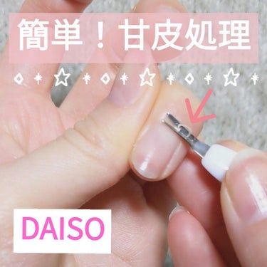 DAISO 甘皮切り&つめやすりのクチコミ「動画あり🙋🏻‍♀️
DAISO 甘皮切り&つめやすり 

ニッパーよりも簡単に処理できて、何よ.....」（1枚目）