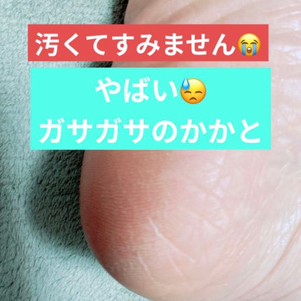 かかとちゃん/桐灰化学/レッグ・フットケアを使ったクチコミ(4枚目)