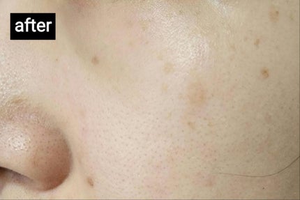 (旧)アンリミテッド ラスティング フルイド/shu uemura/リキッドファンデーションを使ったクチコミ(4枚目)