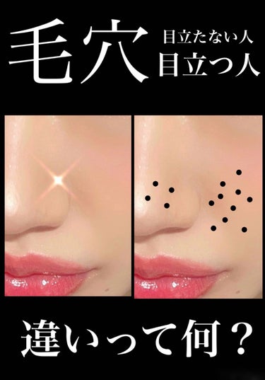 ｲｴﾍﾞちゃん🥰365日ｽｷﾝｹｱで脳がいっぱい on LIPS 「毛穴が目立つ人と目立たない人っていますよね‼️違いってなんだろ..」（1枚目）