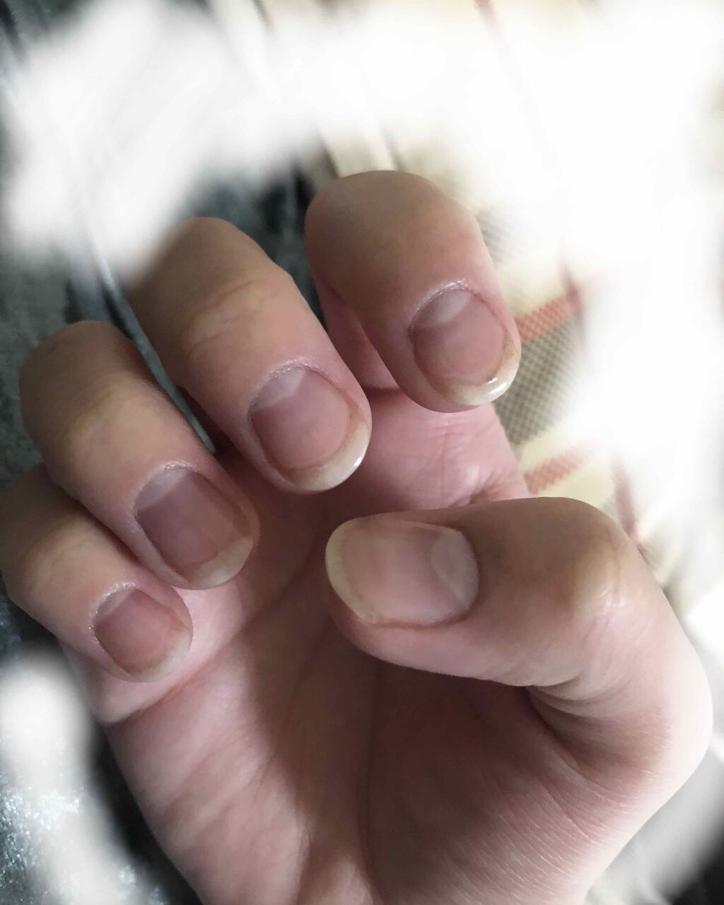 ネイルベッドオイル/アンドネイル/ネイルオイル・トリートメントを使ったクチコミ(2枚目)