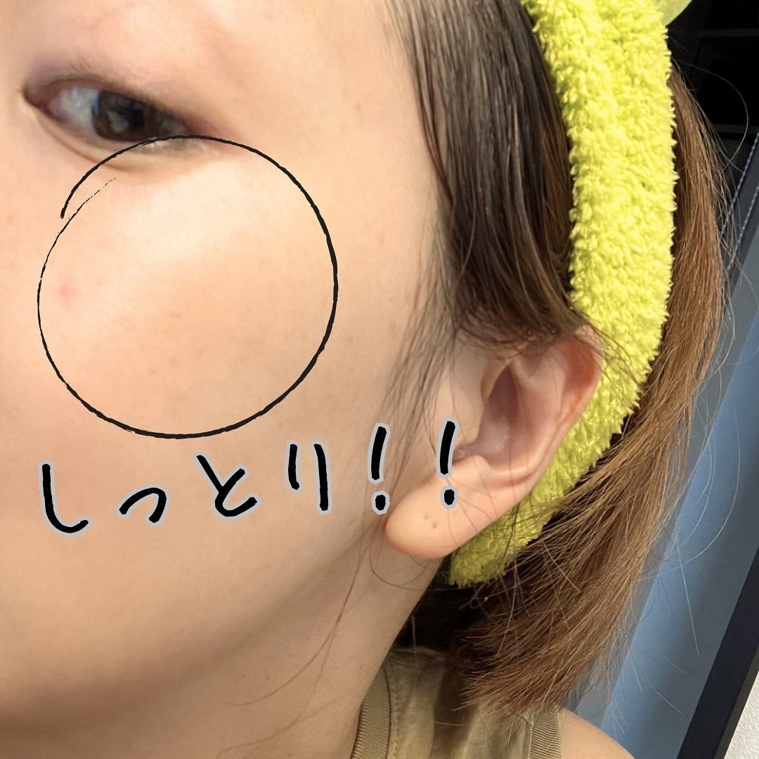 お米のパック/毛穴撫子/洗い流すパック・マスクを使ったクチコミ(4枚目)