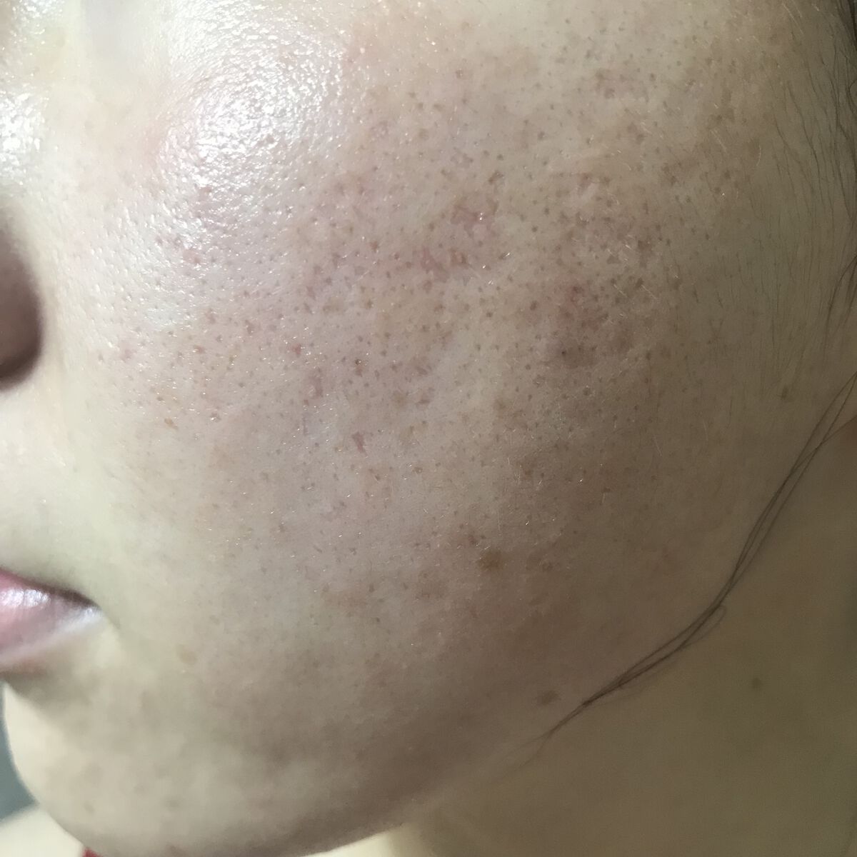 The Ordinary vitamin c suspension 30% in siliconeのクチコミ「7/5(火)の#汚肌工事録
(この日は腸活なし✍️)

\いつも💕ありがとうございます🙏うれし.....」（2枚目）