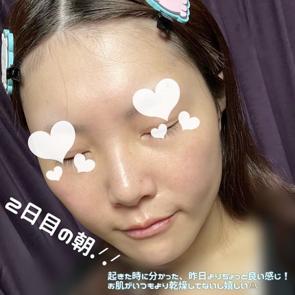 PDRN リードルショット100/VT/ブースター・導入液を使ったクチコミ(5枚目)