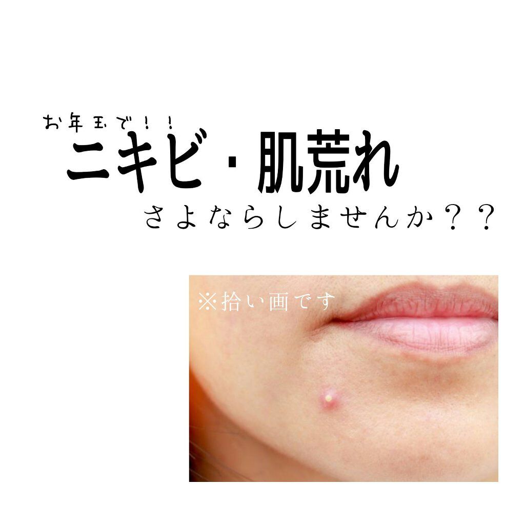 クリアモイスチャー M（しっとりタイプ）/オルビス/乳液を使ったクチコミ（1枚目）