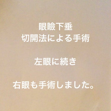 おみなえしこけし on LIPS 「眼瞼下垂切開法による手術左眼に続き右眼も手術しました。前回の左..」（2枚目）