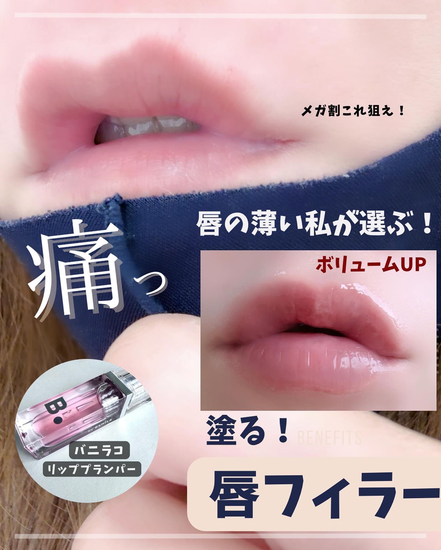 ボリュームリッププランパー/BANILA CO/リッププランパーを使ったクチコミ（1枚目）
