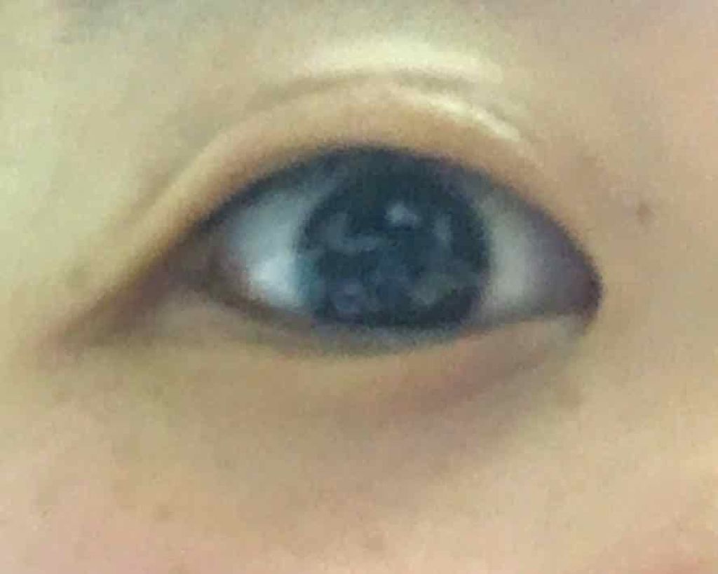 アイビューティー フィクサー WP/アストレア ヴィルゴ/二重まぶた用アイテムを使ったクチコミ（3枚目）