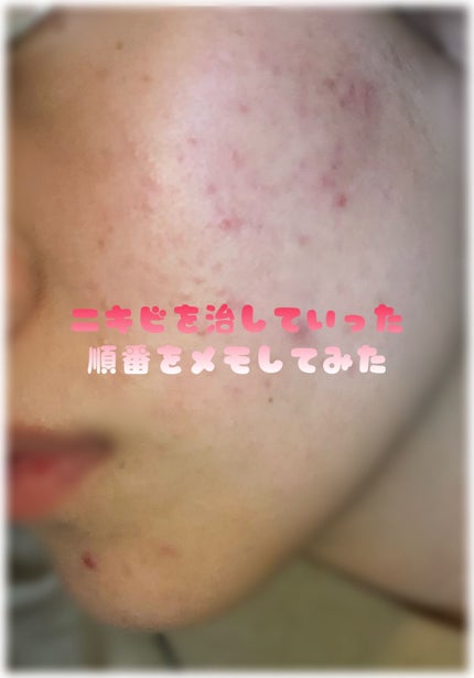 薬用 雪肌精/雪肌精/化粧水を使ったクチコミ(1枚目)