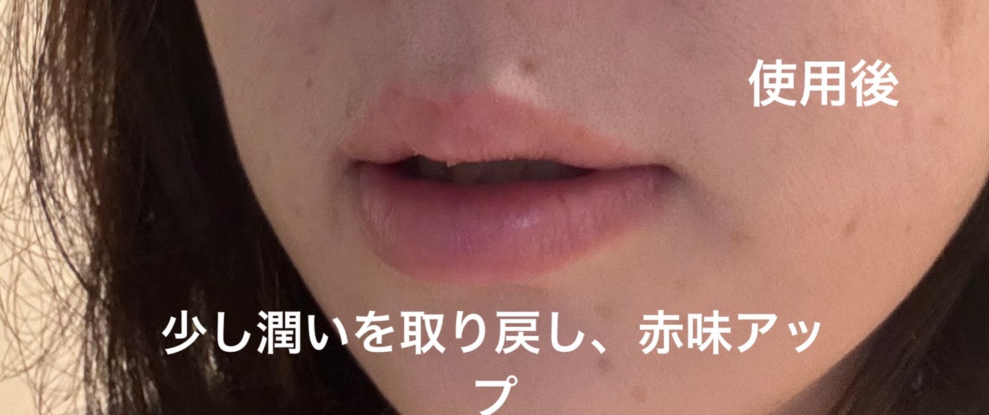 モアリップ N (医薬品)/資生堂薬品/その他を使ったクチコミ(4枚目)
