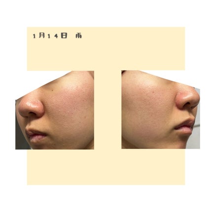 メイク落とし パーフェクトオイル/ビオレ/オイルクレンジングを使ったクチコミ(2枚目)