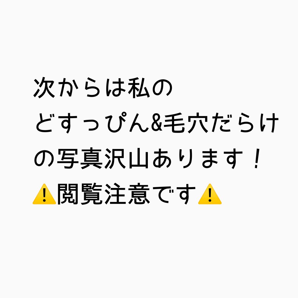 フィットミー コンシーラー/MAYBELLINE NEW YORK/リキッドコンシーラーを使ったクチコミ（2枚目）