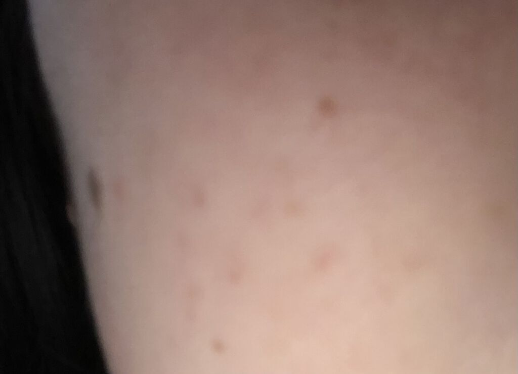 AHA·BHA·PHA 30デイズミラクルトナー/SOME BY MI/化粧水を使ったクチコミ（2枚目）