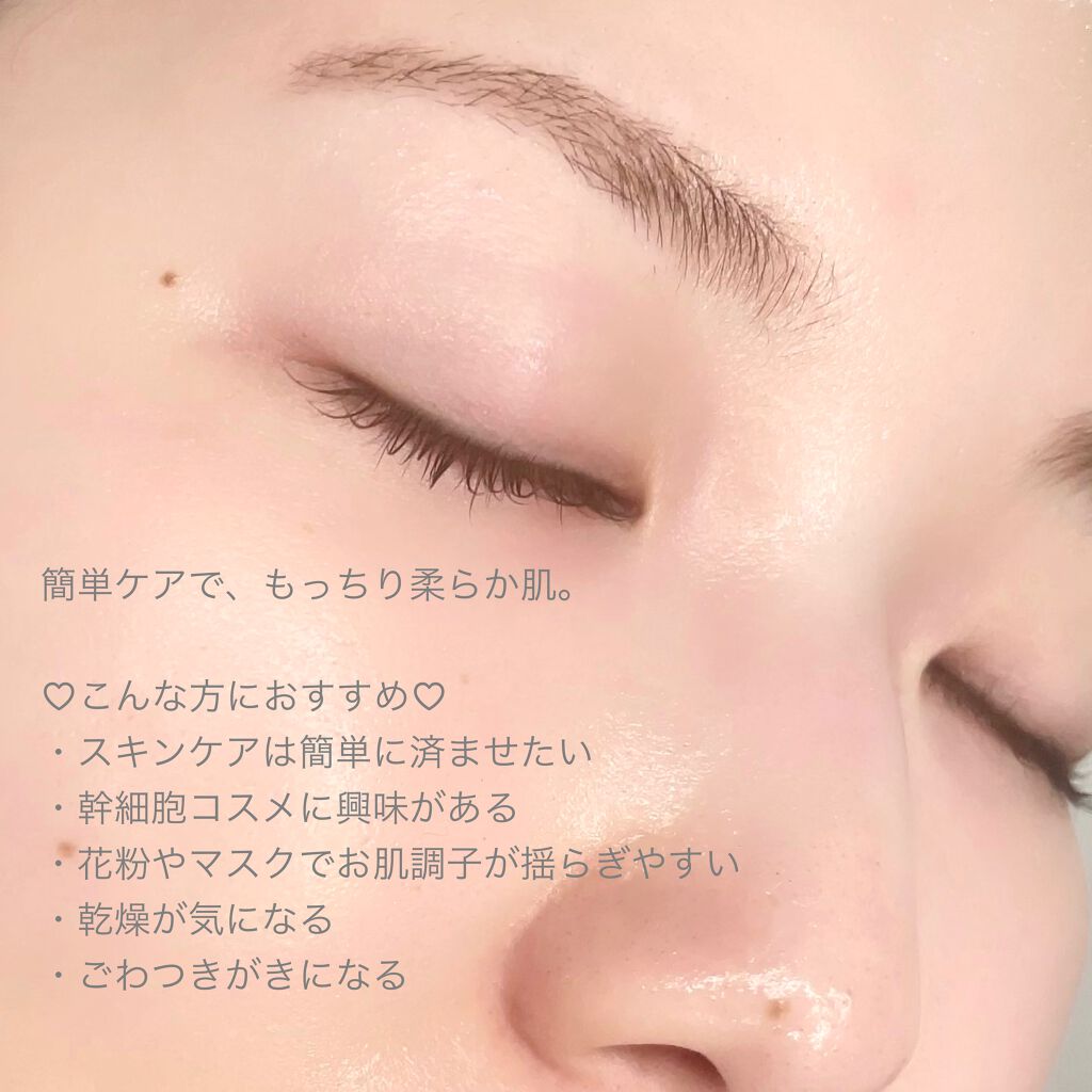 モイスト ミルクエッセンス/リッツ/乳液を使ったクチコミ(5枚目)