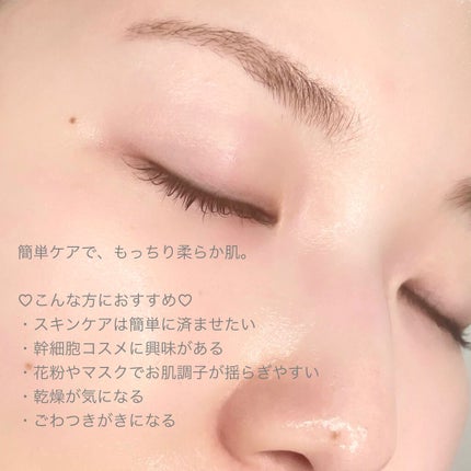 モイスト ミルクエッセンス/リッツ/乳液を使ったクチコミ(5枚目)