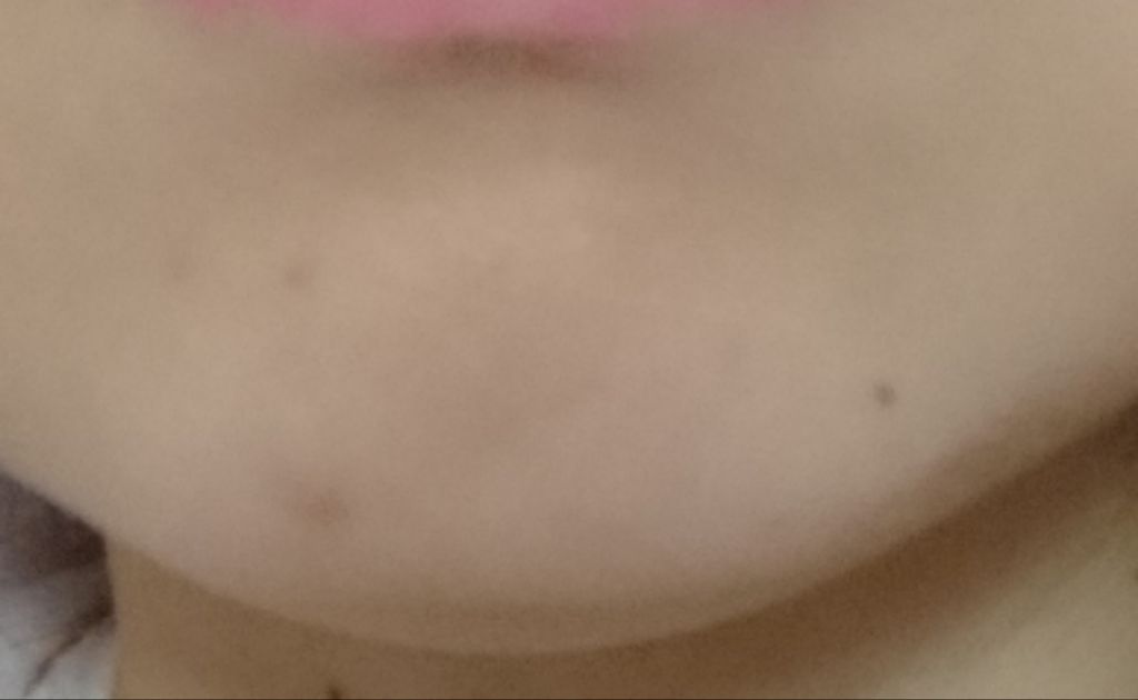 Power10フォーミュラ VCエフェクター/It's skin/美容液を使ったクチコミ(3枚目)