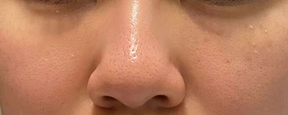 明色美顔水 薬用化粧水/美顔/化粧水を使ったクチコミ(4枚目)