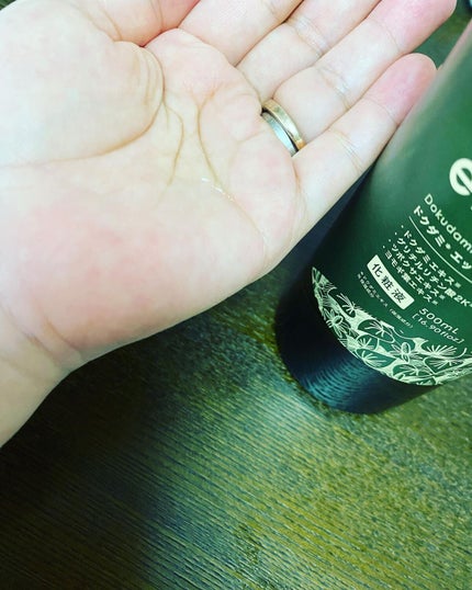 ドクダミ エッセンスローション /enieni /化粧水を使ったクチコミ(3枚目)