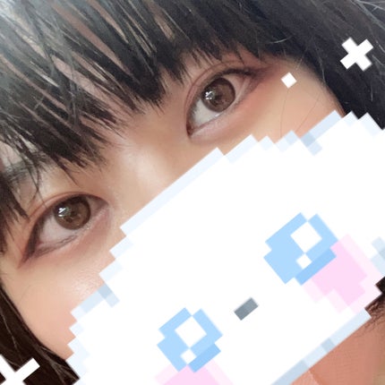 りんごあめ on LIPS 「先日、二重整形の埋没法の施術を受けてから1年が経過しました🙌✨..」(4枚目)