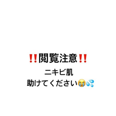 助けてください😭💦
久しぶりにメイクをしたらメイク後にも関わらずメイクして半日経ったの？！というくらい汚い😭
皮膚科にも通っています、ありとあらゆるスキンケアもしてきて肌が汚いのが悩みです😭
鼻はボツボ