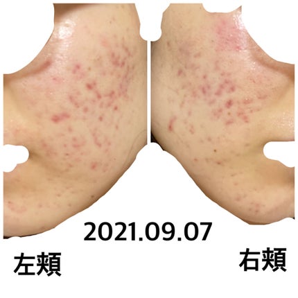 を使ったクチコミ(1枚目)