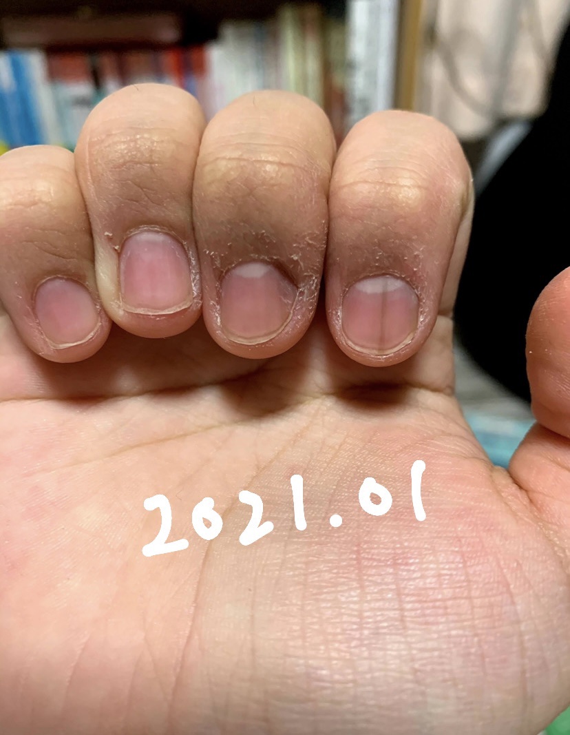 エテュセ クイックケアコート/ettusais/ネイルオイル・トリートメントを使ったクチコミ（2枚目）