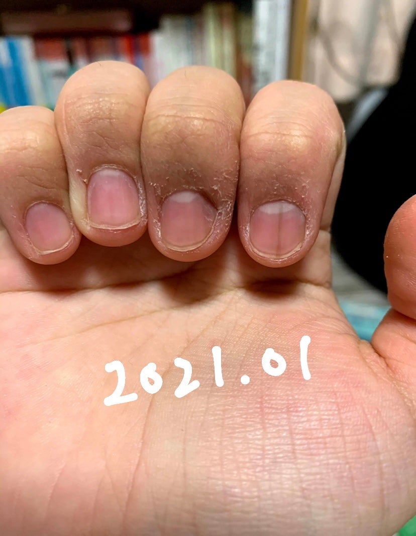 エテュセ クイックケアコート/ettusais/ネイルオイル・トリートメントを使ったクチコミ(2枚目)