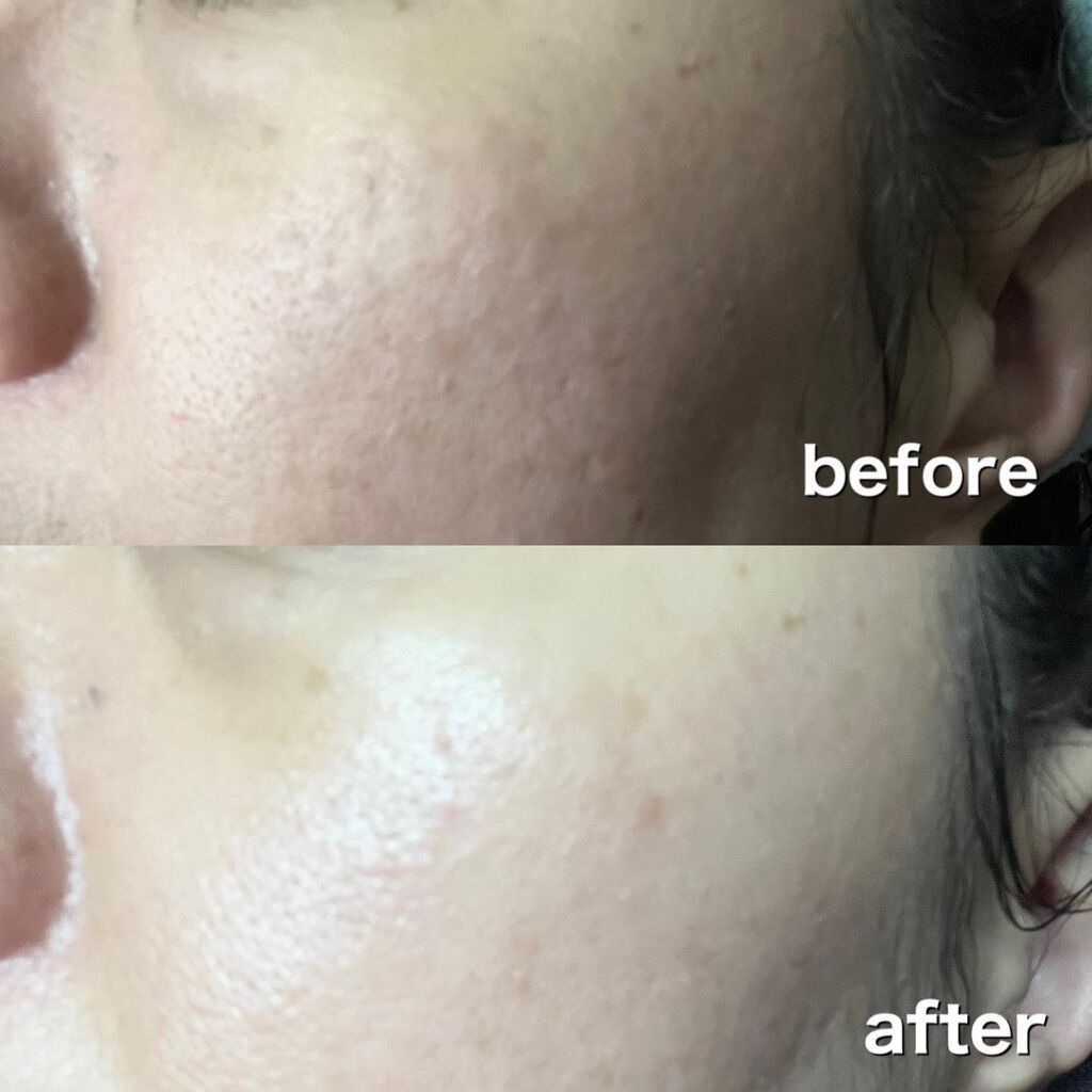 BHA+ ポアゼロトナー/be the skin/化粧水を使ったクチコミ(10枚目)