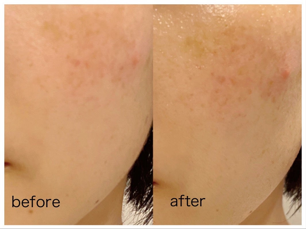 バイオームビタCダークスポットセラム/UIQ/美容液を使ったクチコミ(7枚目)