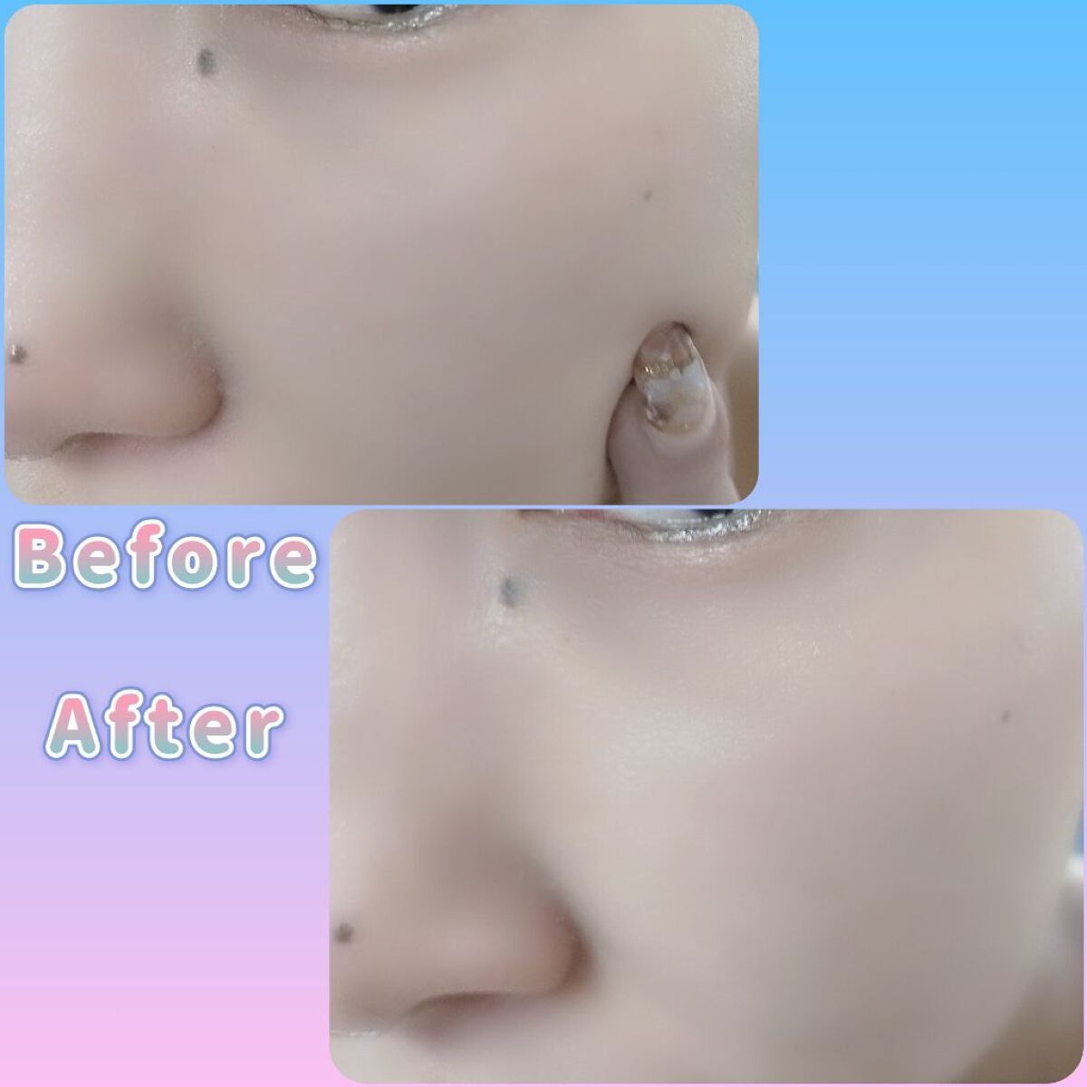 ダヴ 吸着毛穴ケア 洗顔ジェル/ダヴ/その他洗顔料を使ったクチコミ(4枚目)