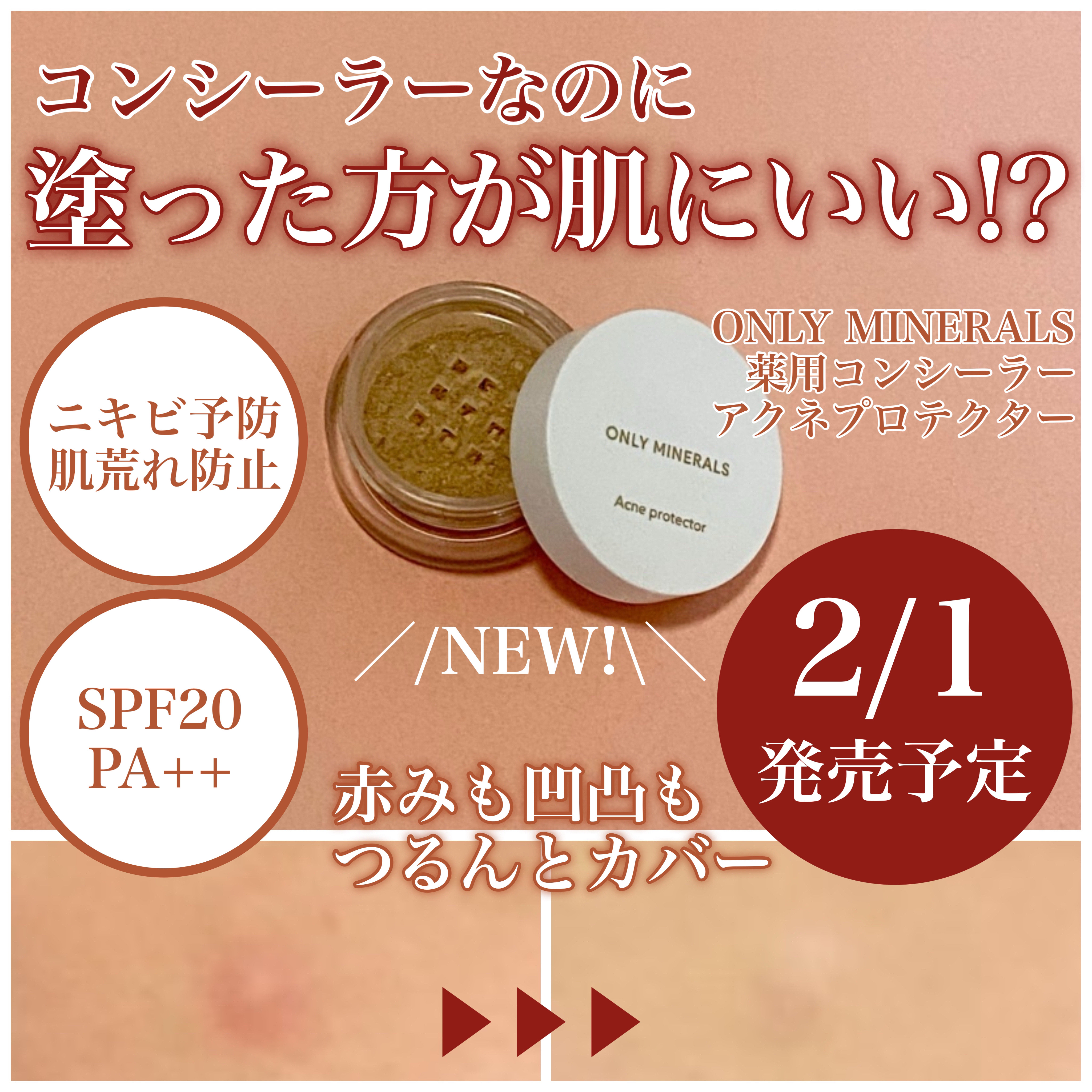 薬用コンシーラー アクネプロテクター/ONLY MINERALS/パウダーコンシーラーを使ったクチコミ（1枚目）