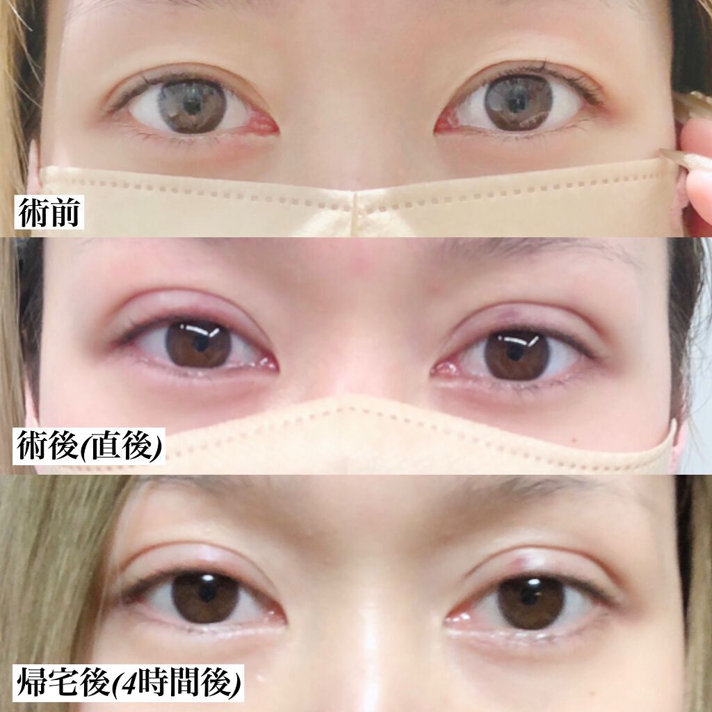 ドクダミ 77 スージングトナー/Anua/化粧水を使ったクチコミ（3枚目）