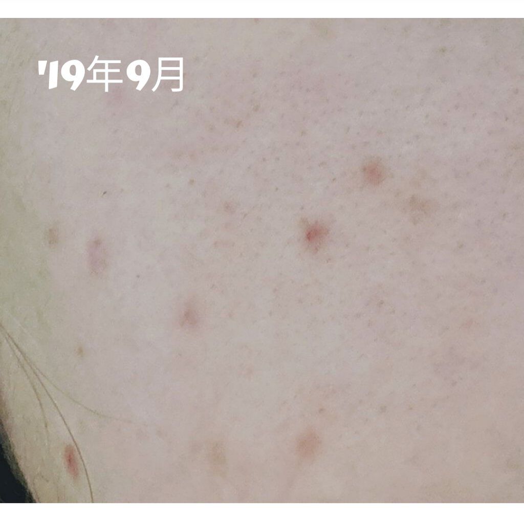 ヘルプミー! ダクトパッド/One-day's you/トナーパッドを使ったクチコミ（2枚目）