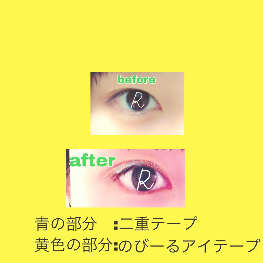 のびーるアイテープ（絆創膏タイプ、レギュラー）/DAISO/二重まぶた用アイテムを使ったクチコミ（2枚目）
